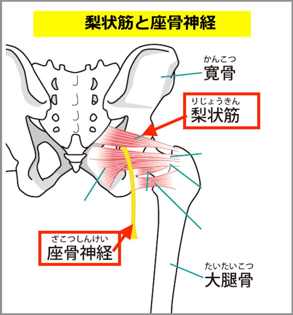 お尻　痛み　本　梨状筋 梨状筋症候群 - 瑞穂いとう接骨院（岐阜県瑞穂市）